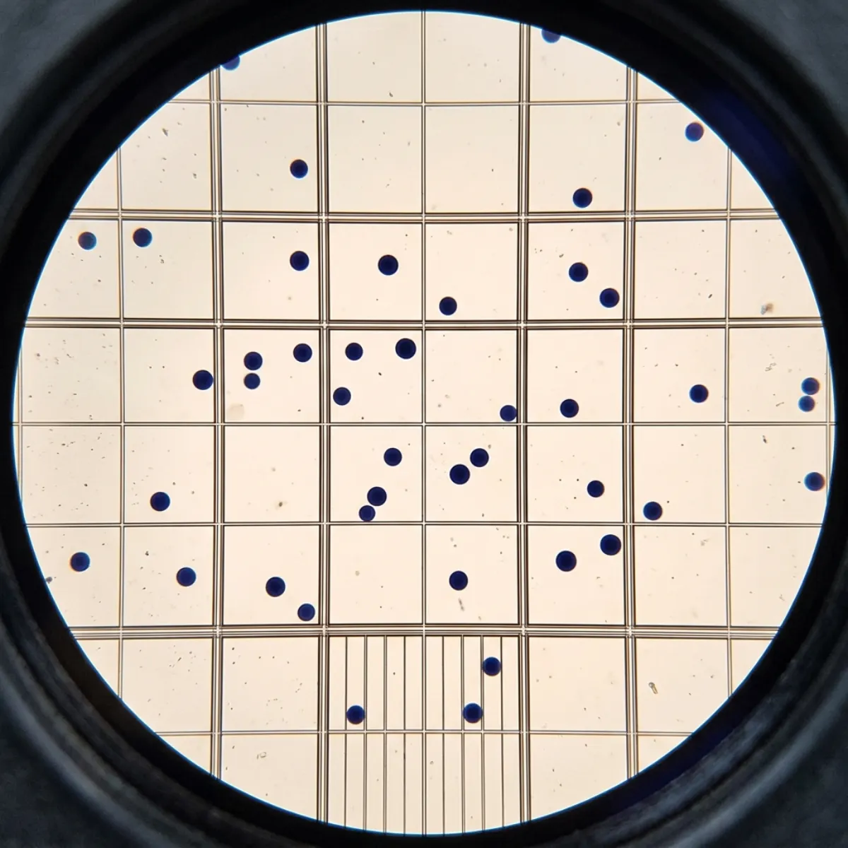 Microscope view of a hemocytometer grid with stained cells visible in the counting quadrants
